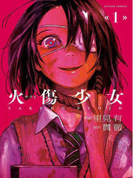 火伤少女